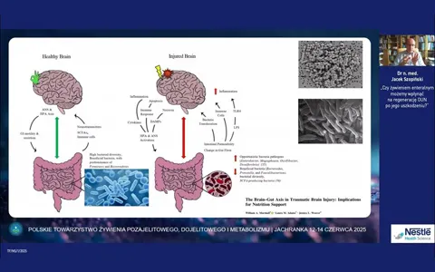 Czy żywieniem enteralnym możemy wpłynąć na regenerację OUN po jego uszkodzeniu? - Dr. Szopiński.